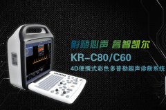 國產(chǎn)彩超機價格哪個好?選購彩超機注