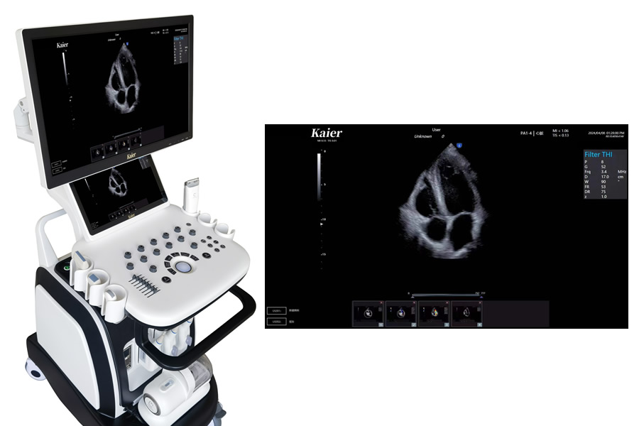 心臟彩超機(jī)做心臟彩超