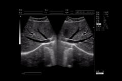 不同部位B超檢查前的準備工作有哪些？