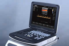 【彩超機(jī)】彩超設(shè)備能檢查出什么？