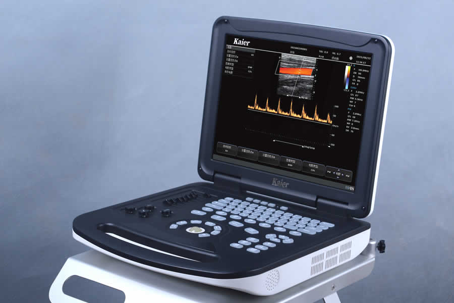 【彩超機(jī)】彩超設(shè)備 