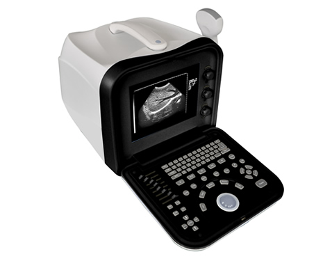 便攜式全數(shù)字B超