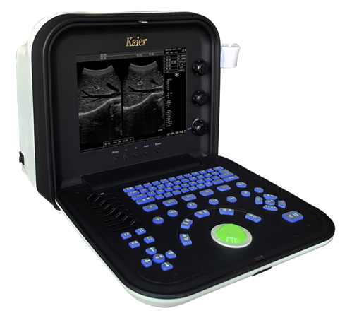KR-1288Z液晶便攜式B超