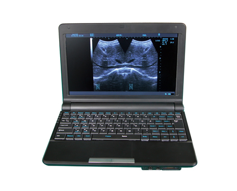 全數(shù)字筆記本B超
