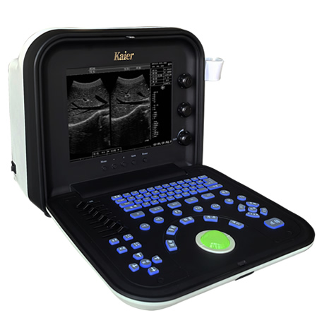 便攜式液晶全數(shù)字B超