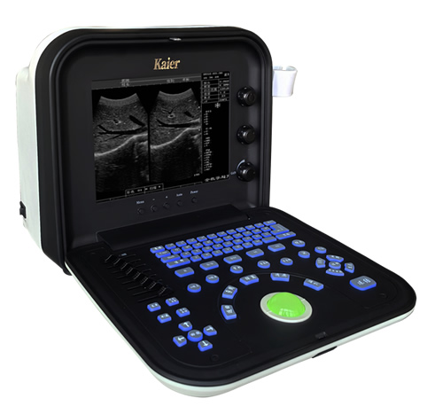 便攜式液晶全數(shù)字B超