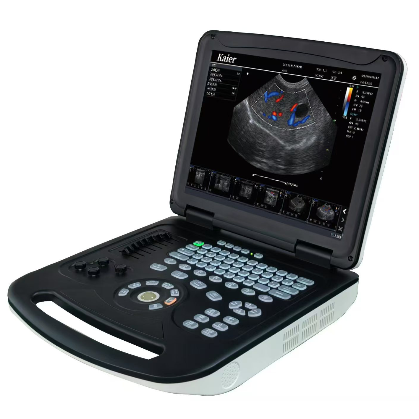 KR-E80筆記本式彩超機(jī)