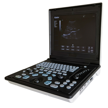 筆記本B超機